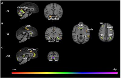 Neuroanatomical correlates of individual differences in the object choice task in chimpanzees (Pan troglodytes)